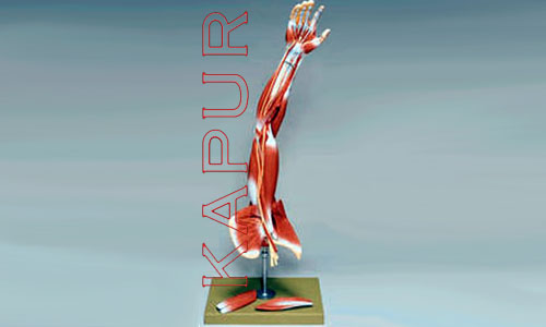 Arm