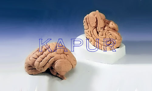 Brain 2 Parts