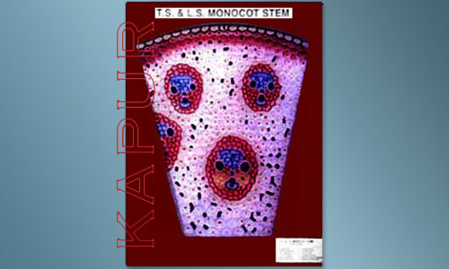T.S & L.S Monocot Stem