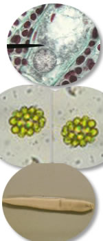Prepared Slides,Cyanophyceae (Blue Green Algae),Chlorophyceae (Green Algae),Phaeophyceae,Rhodophyceae,Fungi Phycomycetes,Acsomycetes,Basidiomycetes,Lichens,Bryophytes,Pteridophytes,Lichens,Gymnosperms,Angiosperms,Tissues,Palynology,Protozoa,Porifera,Cocelenterata,Platyhelminthes,Annelida,Arthropoda (Insecta),Mollusca,Protochordates,Pisces,Amphibia Histology,Mammalian Histology,Parasitology