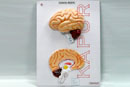 Human Brain