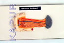 Pancreas Sectioned
